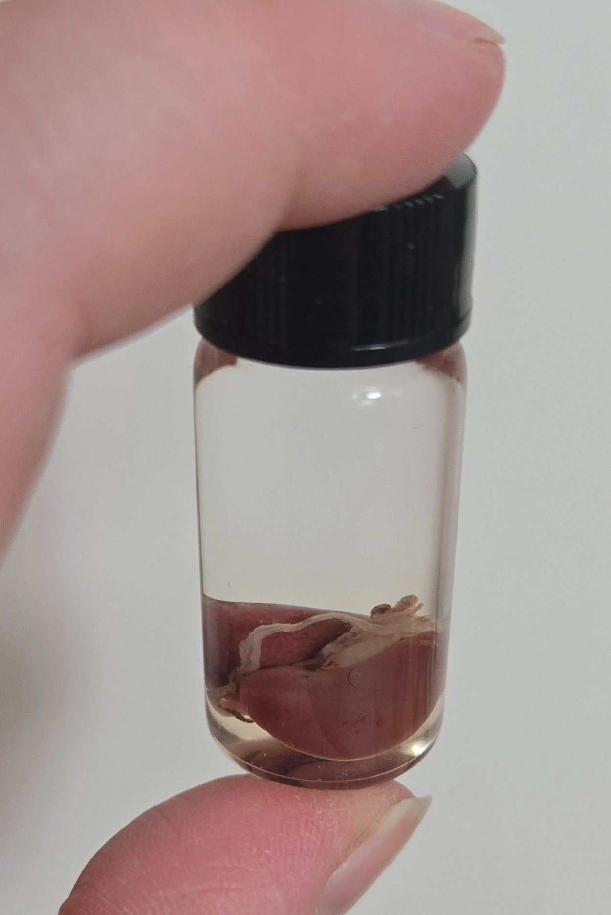 Mouse kidneys